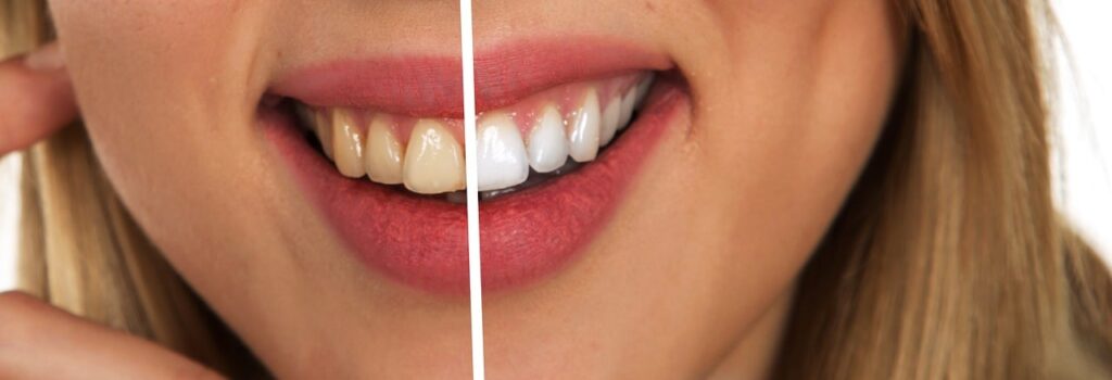 Mastering the Art of Proper Tooth Brushing: Techniques and Tips