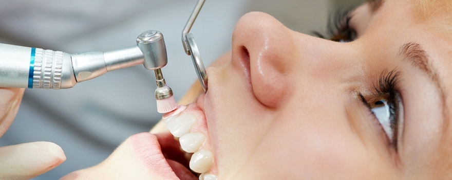 Dental Stone Cleaning: How Often Should It Be Done?