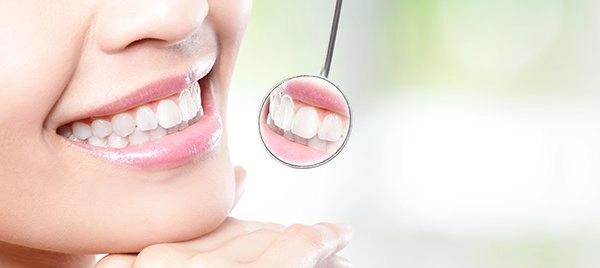 Porcelain veneers before and after