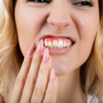 Are Bleeding Gums a Sign of Something Bigger?